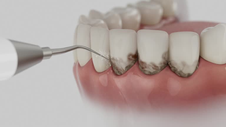 Trusted Teeth Cleaning And Checkup service in Phoenix, AZ - Dentist Open Now